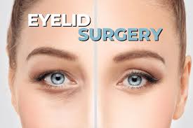risks and benefits of eyelid surgery