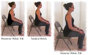 Anterior Pelvic Tilt Sitting Position Online Shop, UP TO 58% OFF |  www.editorialelpirata.com
