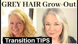 This is most likely a perception phenomenon, dawson and other hair (white hairs can result from an underlying pigmentation issue on one part of the body, like vitiligo, or even from a. Growing Out Grey Hair Silver White Gray Natural Transitions Youtube