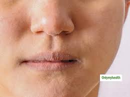 causes of dry skin around the mouth