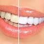 Create Changes Implant, Invisalign and Cosmetic Dentist Unit 11a Mermaid Quay Cardiff Bay from diamonddentalspa.com