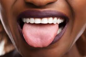 white spots on tongue sore