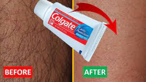 hair removal cream using toothpaste