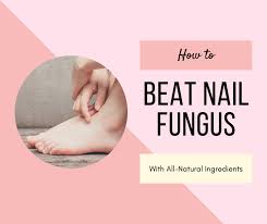 10 natural remes to get rid of nail