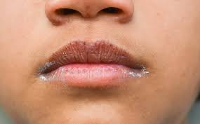 ed lip corners you may be dealing