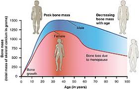 Osteoporosis Wikipedia