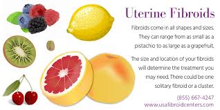 A Visual Guide To Uterine Fibroids And Treatments Uterine