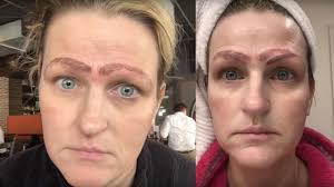 microblading fail woman has 4 eyebrows
