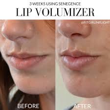 senederm lip volumizer life on beacon