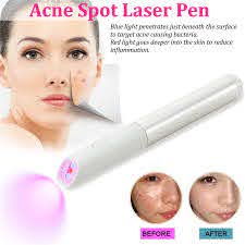 Blue Red Light Therapy Acne Spot Treatment Laser Pen Scar Wrinkle Removal Device Blackhead Blemish Remover Face Skin Care Tool Home Use Beauty Devices Aliexpress