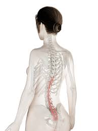 pain after spinal fusion may be from