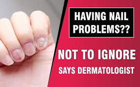 having nail problems not to ignore