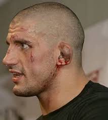 Let's visit why do fighters get we know you've seen them before. 10 Cauliflower Ears Ideas Cauliflower Ear Cauliflower Ear