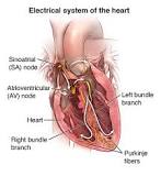 Image result for Whats the meaning of ECG Test