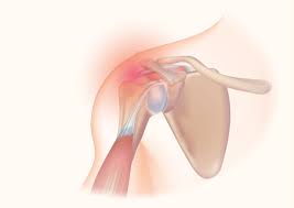 pain in and under the shoulder blade