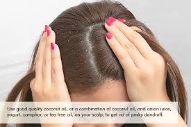 3 hair scalp diseases that coconut oil