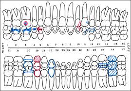 Dental Charting Tooth Surfaces Www Bedowntowndaytona Com