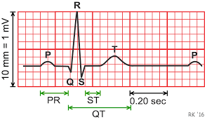 Cv Physiology Electrocardiogram Ekg Ecg