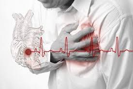 Você sabe o que é o infarto do coração? - Dr Gabriel Doreto