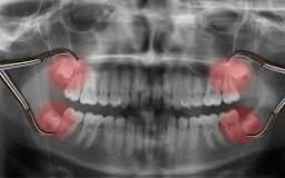 Image result for what is Dental Surgery