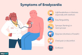 sinus bradycardia causes symptoms