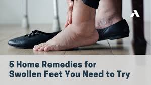 5 home remes for swollen feet you