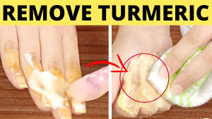 remove turmeric stains from nails