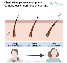 changes in hair texture chemoexperts