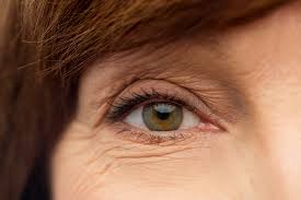what if i blink during cataract surgery
