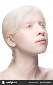 portrait of beautiful albino woman