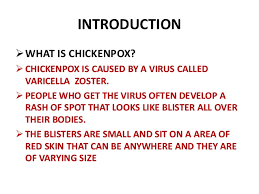 Chickenpox Ppt