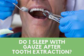 Wait for the time recommended by your dentist. Do I Sleep With Gauze After Tooth Extraction Water Flosser Guide