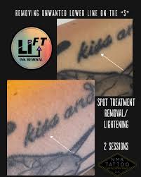 li ft saline tattoo lightening