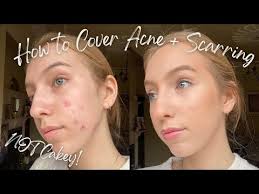 how to apply makeup on acne scarring