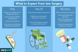 jaw surgery preparation procedure