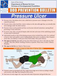 preventing pressure ulcers health and