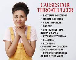 home remes for throat ulcer