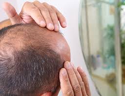 home remes for itchy scalp