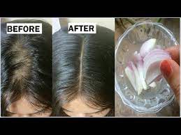 onion coconut oil for extreme hair