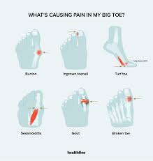 causes of sharp pain in big toe and