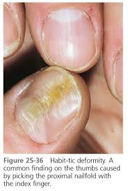 nail diseases
