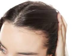 female hair loss causes is it
