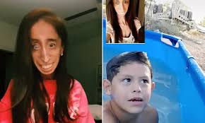 Facebook is showing information to help you better understand the purpose of a page. Lizzie Velasquez Condemns Tiktok Prank In Which Her Face Is Used To Scare Children Daily Mail Online