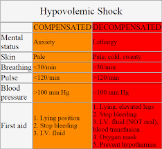 Hypovolemic Shock Table Image Charting For Nurses Nursing
