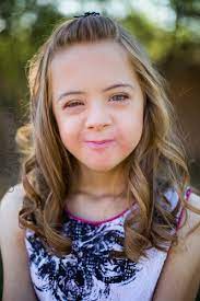 Down syndrome varies in severity among individuals, causing lifelong intellectual disability and developmental delays. Why Disney Doesn T Need A Princess With Down Syndrome Such The Spot