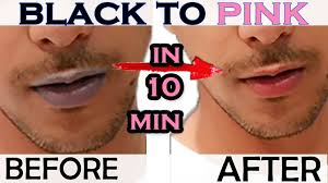 how to get rid of dark lips black lips