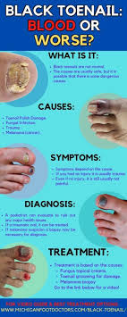 bruising under the toenails causes