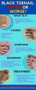 black spot under the toenail causes