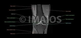 The quadriceps muscles provide strength and power with knee extension. The Knee Mri Atlas Of Anatomy In Medical Imagery