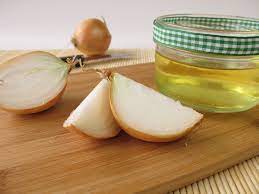 use onion for treating dandruff